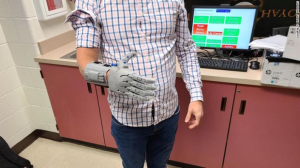 Figure 1‑4: 3D Printed Prosthetic Hand