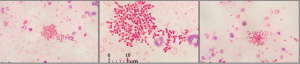 FIGURE 9-4 Methylobacterium
